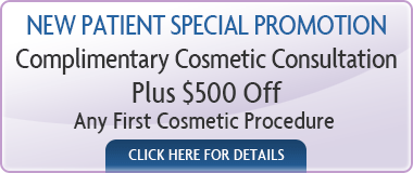 Special Promotion Veneers