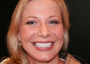 Porcelain Veneers–Wheaton After