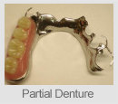 partial denture